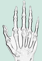 skelettierte Hand